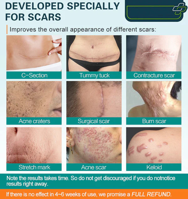 💧 100% Advanced Scar Remove Spray 🕊️ – Smooth Stretch Marks, Keloids & Surgical Scars