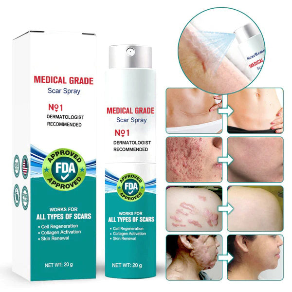 💧 100% Advanced Scar Remove Spray 🕊️ – Smooth Stretch Marks, Keloids & Surgical Scars