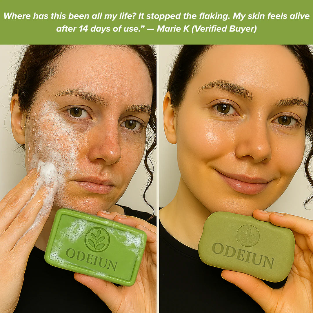 ODEIUN® - 💥 Athlete’s Foot Defense Soap– Fights Itch, Odor & Cracked Skin