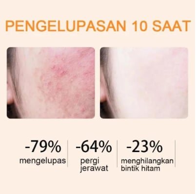 🍊 JEREMYTI™ Orange Enzyme Exfoliating Gel — Brighten Dark Spots & Clear Pores ✨