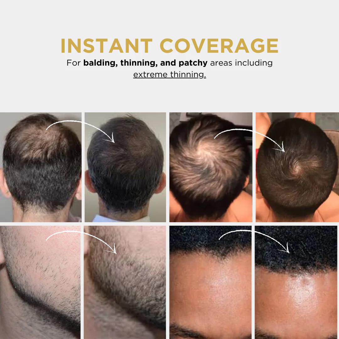 Buy 1 Get 1 Free Today 🎉|💪 ODEIUN™ Hair Filler Powder for Thinning Hair – Natural, Mess-Free